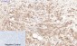 Lactoferrin Monoclonal Antibody(Q100)